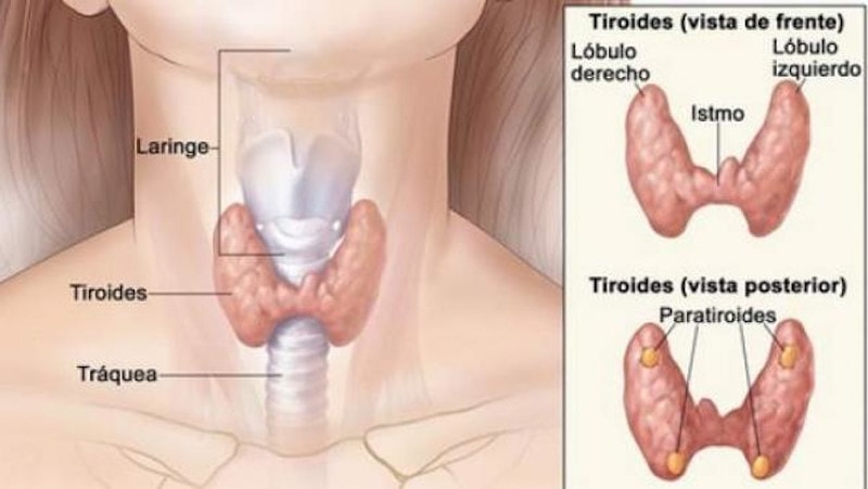 tiroides