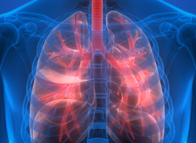 enfermedades-pulmonares