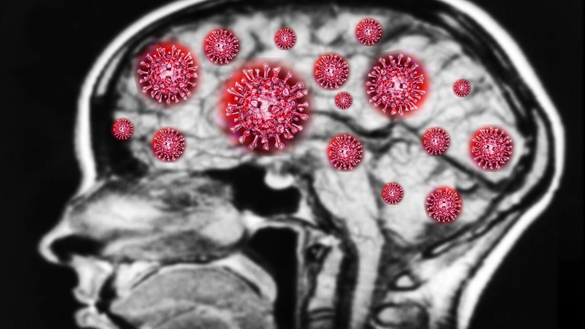 neurología y covid-19