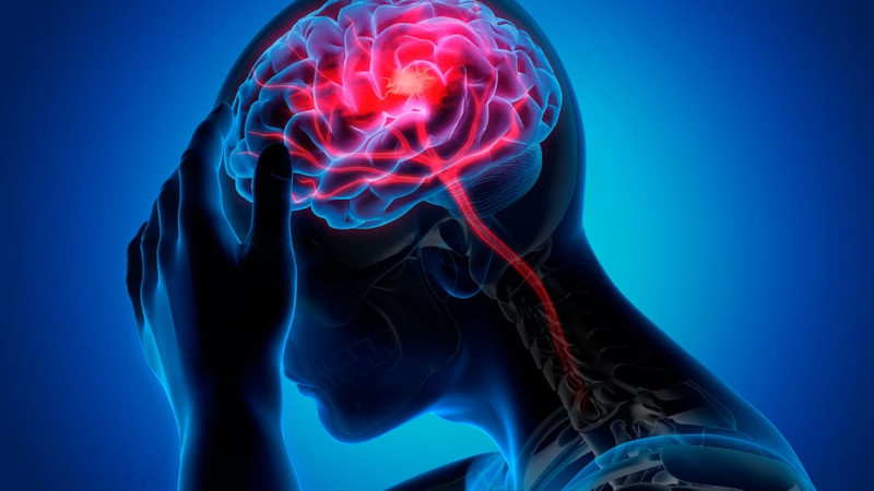 Fisiopatología de la migraña-Disfunción Neuronal Primaria