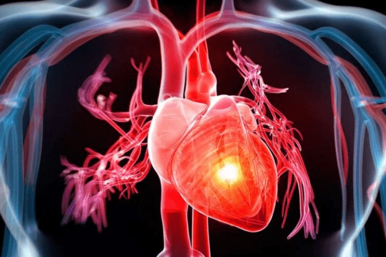 insuficiencia cardiaca