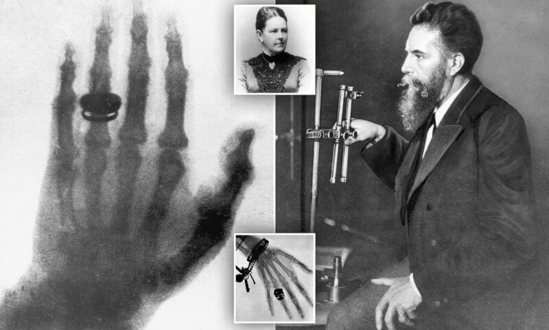 Historia de la Radiología-Wilhelm Conrad Röntgen y Anna Bertha Röntgen