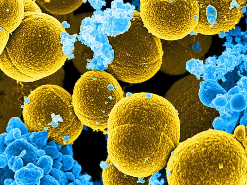 Staphylococcus aureus