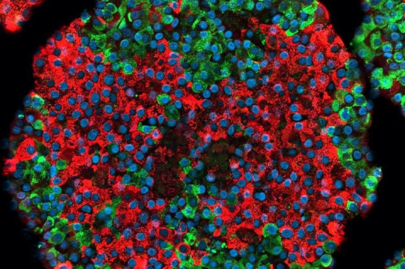 Crean-por-primera-vez-celulas-beta-pancreaticas-funcionales-a-partir-de-celulas-madre