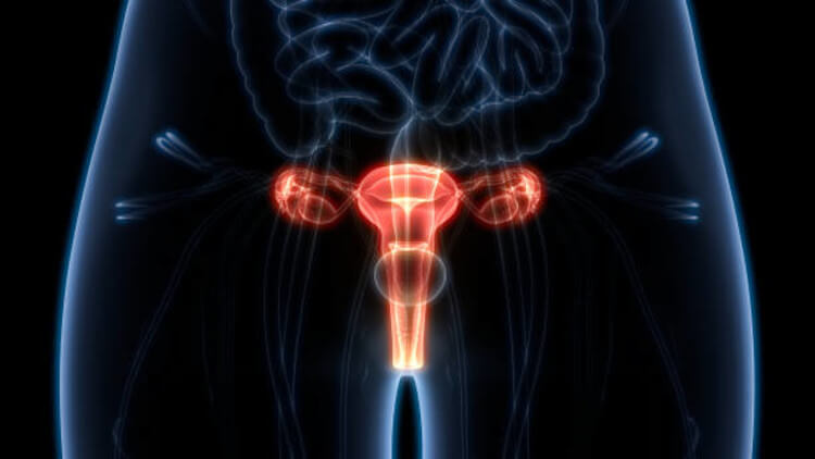 ovarios-cáncer de ovarios