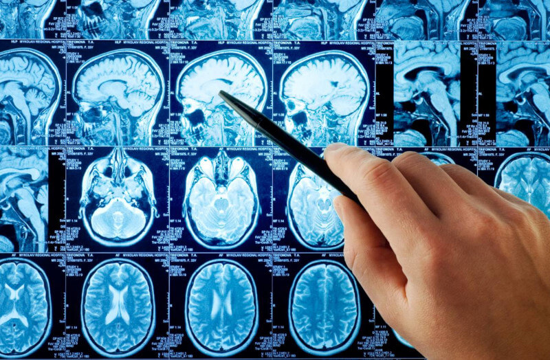 La-inteligencia-artificial-y-anatomia-cerebral