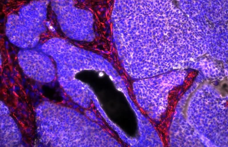 Cáncer de mama en ratón con células tumorales en color blanco. Raúl Jiménez
