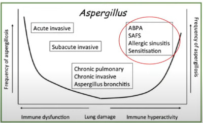 aspergillus