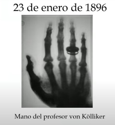 Mano del profesor Rudolf Albert von Kölliker