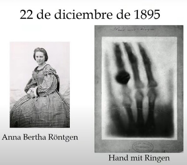 Primera Radiografía en la historia