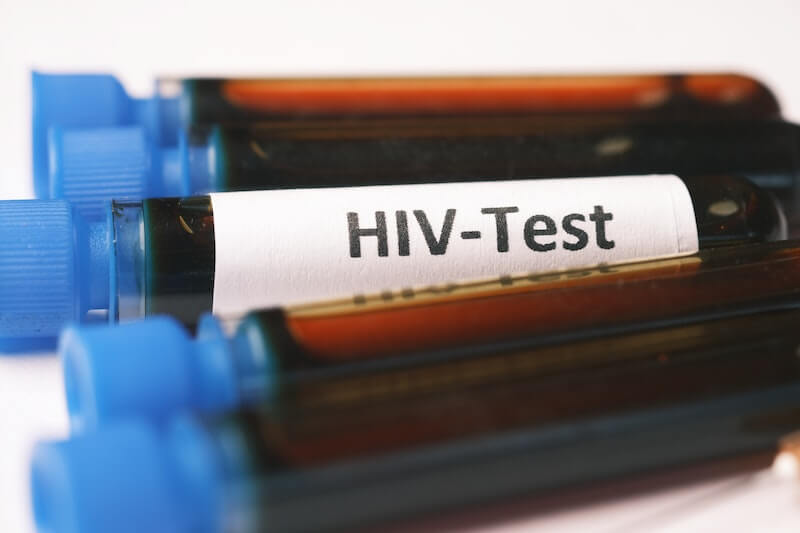 VIH-sida-AIDS-curación