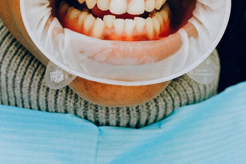 salud bucal-dientes