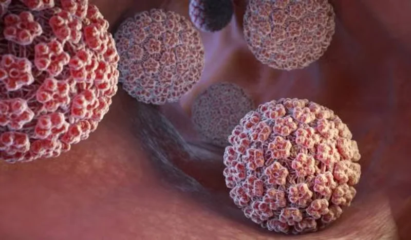 virus-del-papiloma-humano