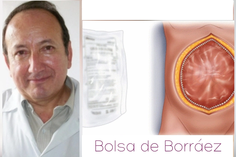 Bolsa_de_Borraez
