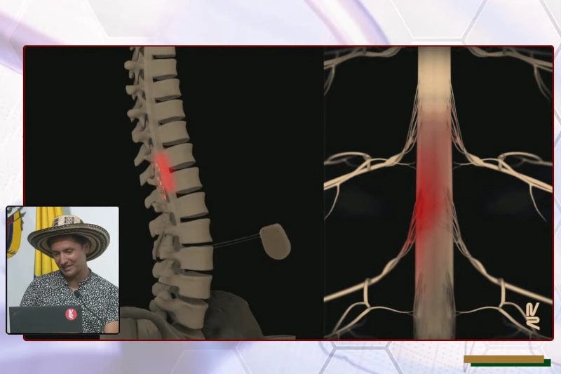 neuroprotesis_y_lesiones_medulares