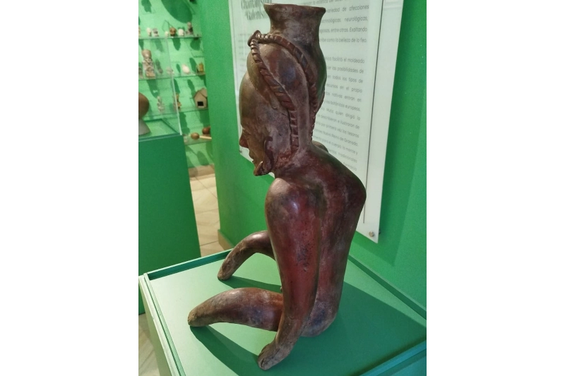 Tuberculosis_en_Pieza_Prehispanica_Cultura_Tumaco
